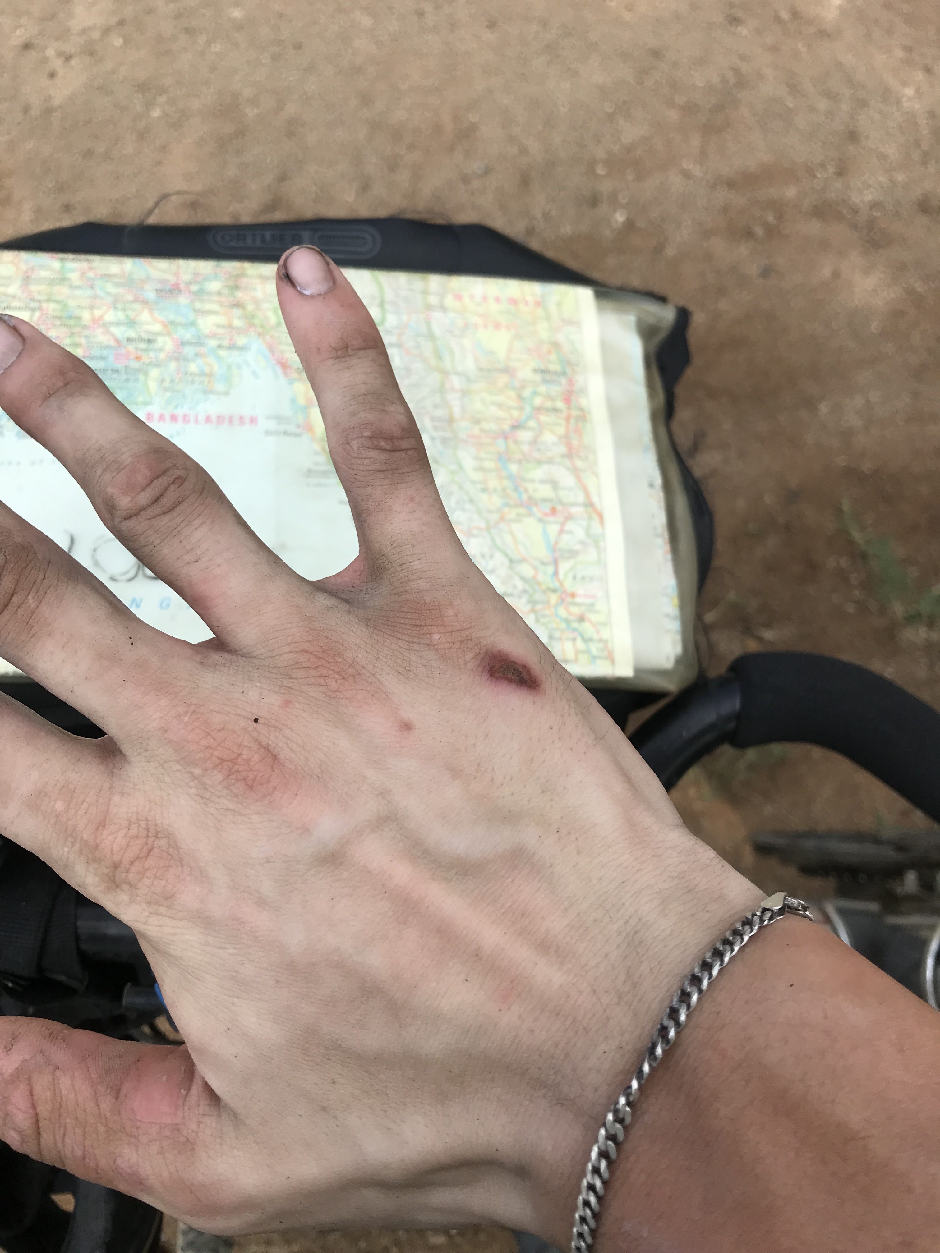 Hit by a Car… Just a Little – Ben Around the World Diary – Day 116 – 2 June 2019